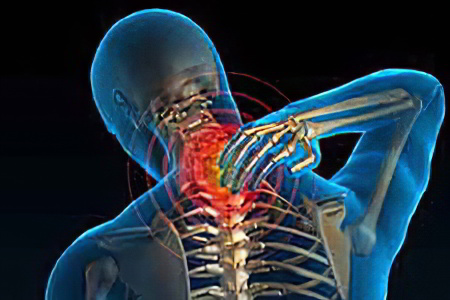 Шейный остеохондроз Шейный остеохондроз