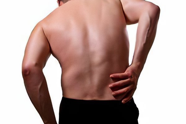 Симптомы пролапса диска Симптомы пролапса диска