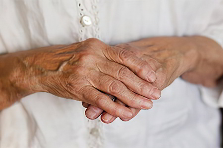 Симптомы ревматоидного артрита Симптомы ревматоидного артрита