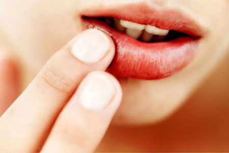 Симптомы герпетического стоматита< Симптомы герпетического стоматита<