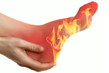 Симптомы жжения в подошвах ног Симптомы жжения в подошвах ног