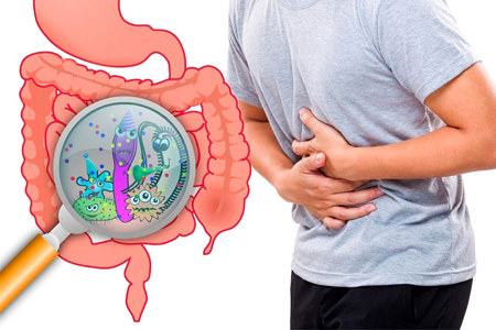 Симптомы нарушения микрофлоры Симптомы нарушения микрофлоры