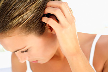 Симптомы педикулёза Симптомы педикулёза