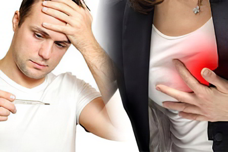 Симптомы саркоидоза Симптомы саркоидоза