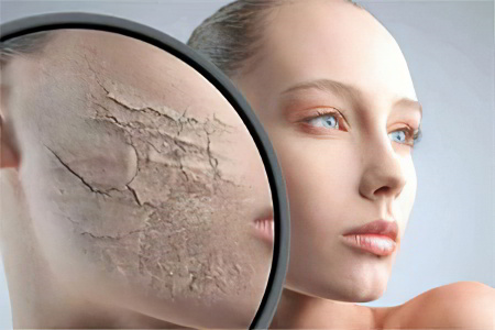 Симптомы сухой кожи Симптомы сухой кожи