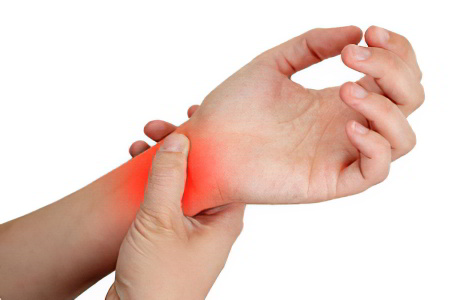 Симптомы синдрома запястного канала Симптомы синдрома запястного канала