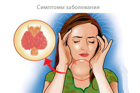 Симптомы увеличения щитовидной железы Симптомы увеличения щитовидной железы