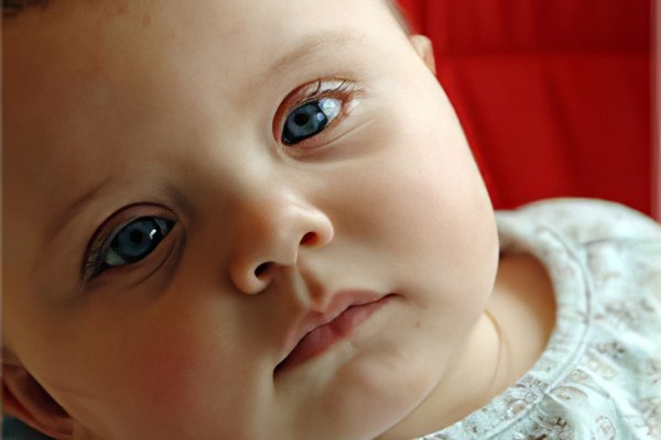 Синяки под глазами у ребёнка Синяки под глазами у ребёнка