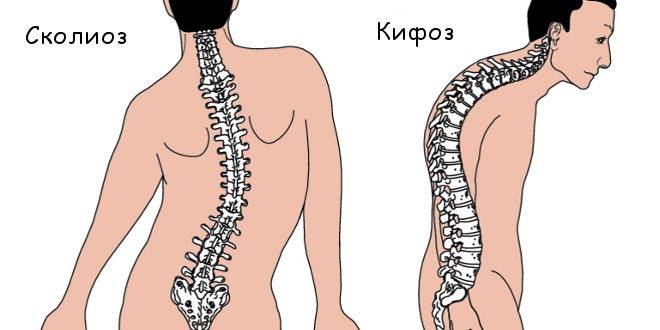 Причины деформации груди Причины деформации груди
