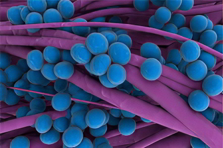 Степени стафилококка Степени стафилококка