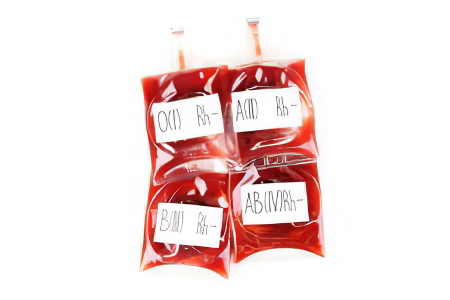 Типы и формы гемофилии Типы и формы гемофилии