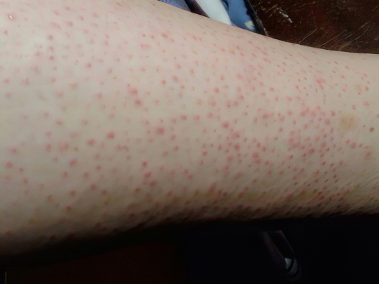 Красные точки Красные точки