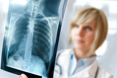 10 мифов о туберкулёзе 10 мифов о туберкулёзе