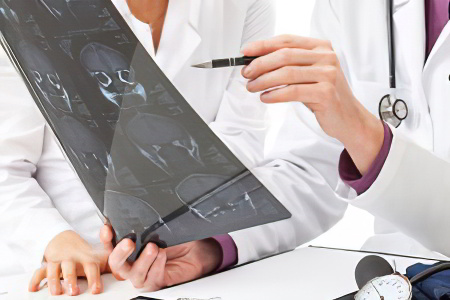 Виды кисты головного мозга Виды кисты головного мозга