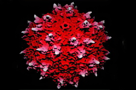 Виды рака молочной железы Виды рака молочной железы