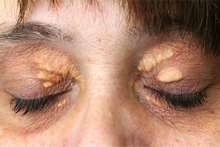 Внешние признаки и симптомы Внешние признаки и симптомы