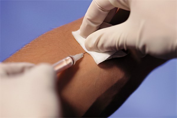 Внутривенное введение Магния сульфата Внутривенное введение Магния сульфата