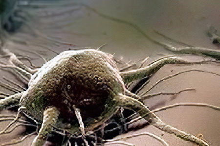 Возбудитель трихомониаза Возбудитель трихомониаза