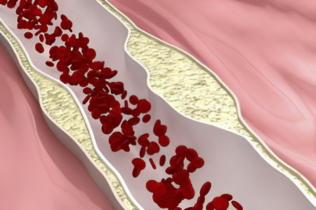 Холестерин Холестерин