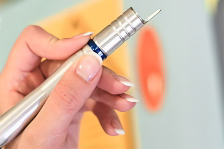 Удаление жировика на лице Удаление жировика на лице