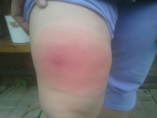 Мошки Мошки