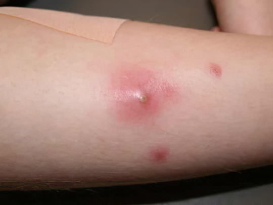 Слепни Слепни