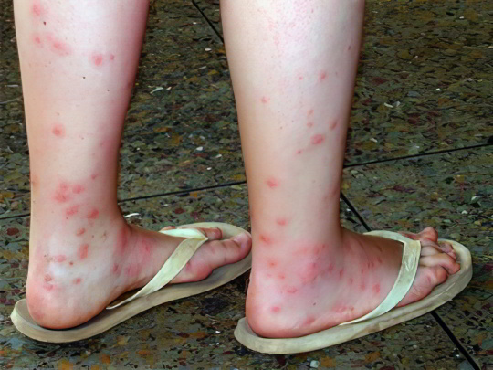 Блохи Блохи