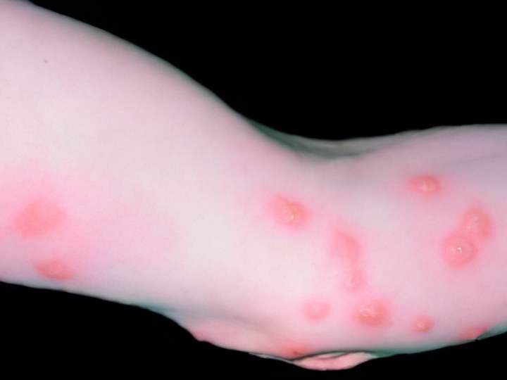 Клопы Клопы