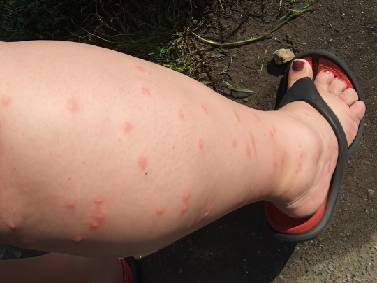 Комары Комары