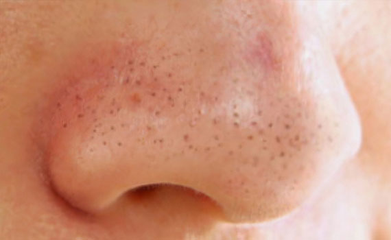 Черные угри Черные угри