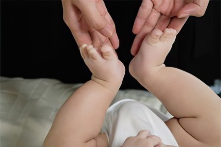 Как определить дисплазию тазобедренных суставов Как определить дисплазию тазобедренных суставов