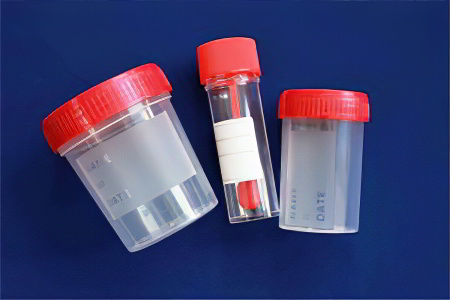 анализ кала на яйца глистов анализ кала на яйца глистов