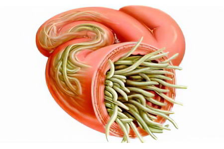 аскаридоз аскаридоз