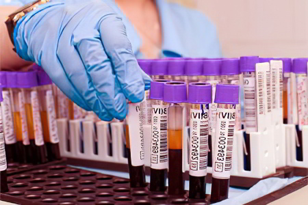 Анализ крови на АСТ Анализ крови на АСТ