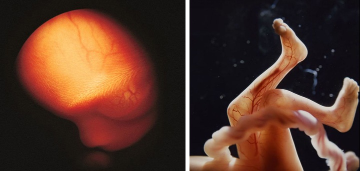 фотографии ребенка на 18 неделе беременности фотографии ребенка на 18 неделе беременности