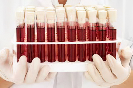 Белок общий в крови Белок общий в крови