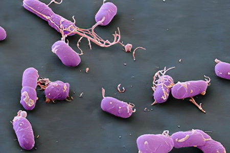 Что провоцирует чума Что провоцирует чума