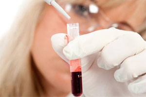 коагулограмма коагулограмма