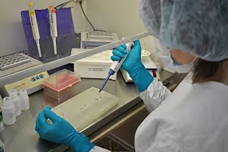 Диагностика чумы Диагностика чумы