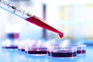 Диагностика ретикулопении Диагностика ретикулопении