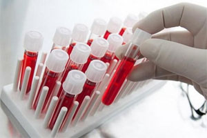 Диагностика моноцитопении Диагностика моноцитопении