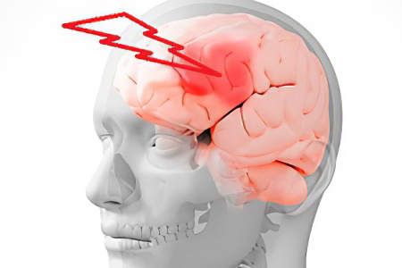 Дефицит витамина В12 и фолиевой кислоты Дефицит витамина В12 и фолиевой кислоты