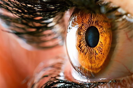 Дистрофия сетчатки глаза Дистрофия сетчатки глаза