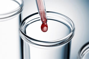 Система гемостаза человека Система гемостаза человека