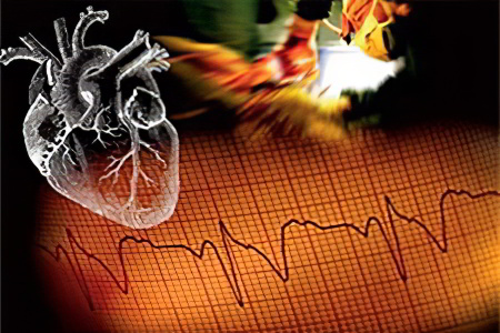 гипертонический криз гипертонический криз