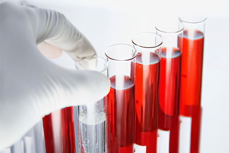 Гормон щитовидной железы Т3 Гормон щитовидной железы Т3