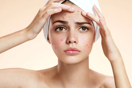 Как бороться с акне Как бороться с акне