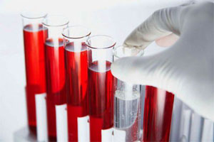 Как определить гиперпротеинемию Как определить гиперпротеинемию