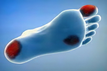 Как возникает Как возникает