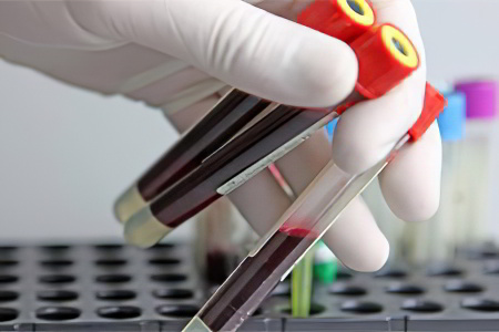 Какие нужно сдать анализы Какие нужно сдать анализы